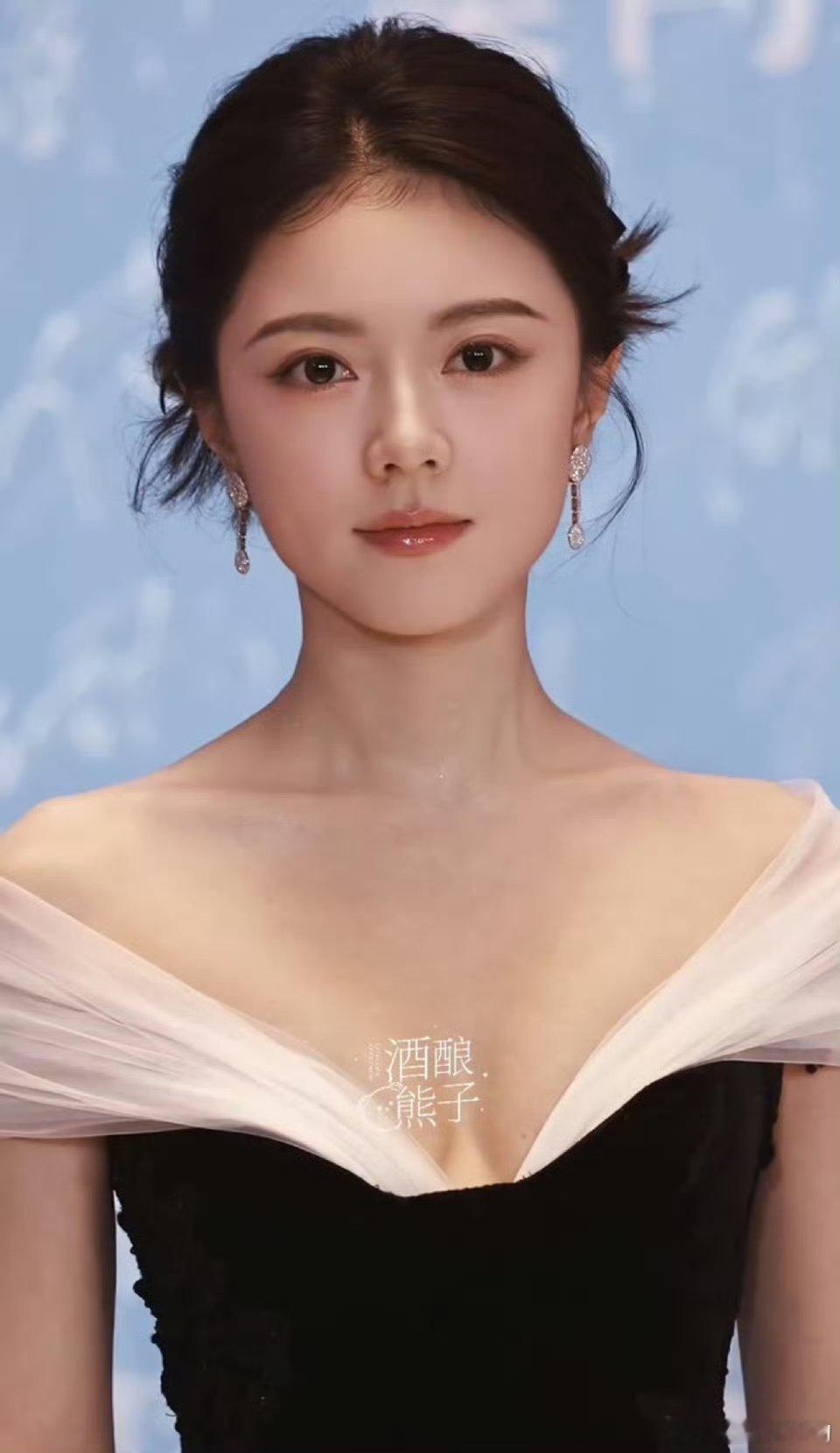 现在小红📚上的医美广告宣传眼部的都用的是她举例，“从眼凸眼鼓显老气到如今的明早