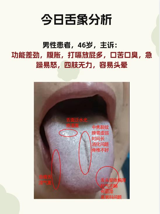 今日舌象分析