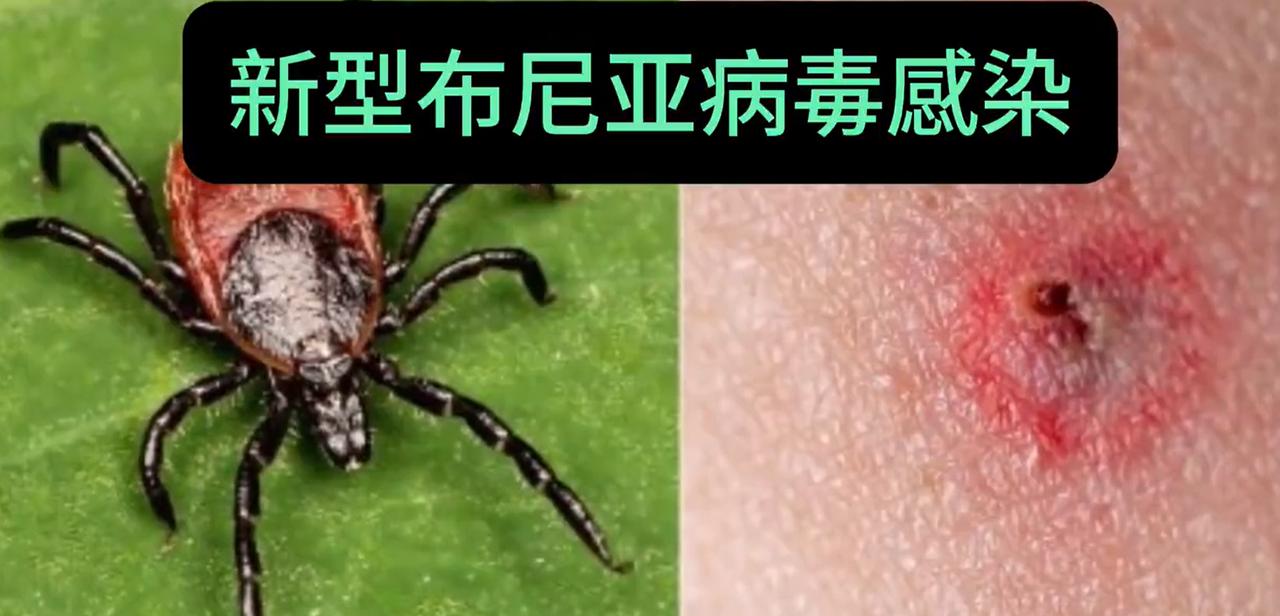 近日，浙江省一居民陈叔86岁的母亲突发恶疾，持续腹泻、全身乏力，没几天就离世了。