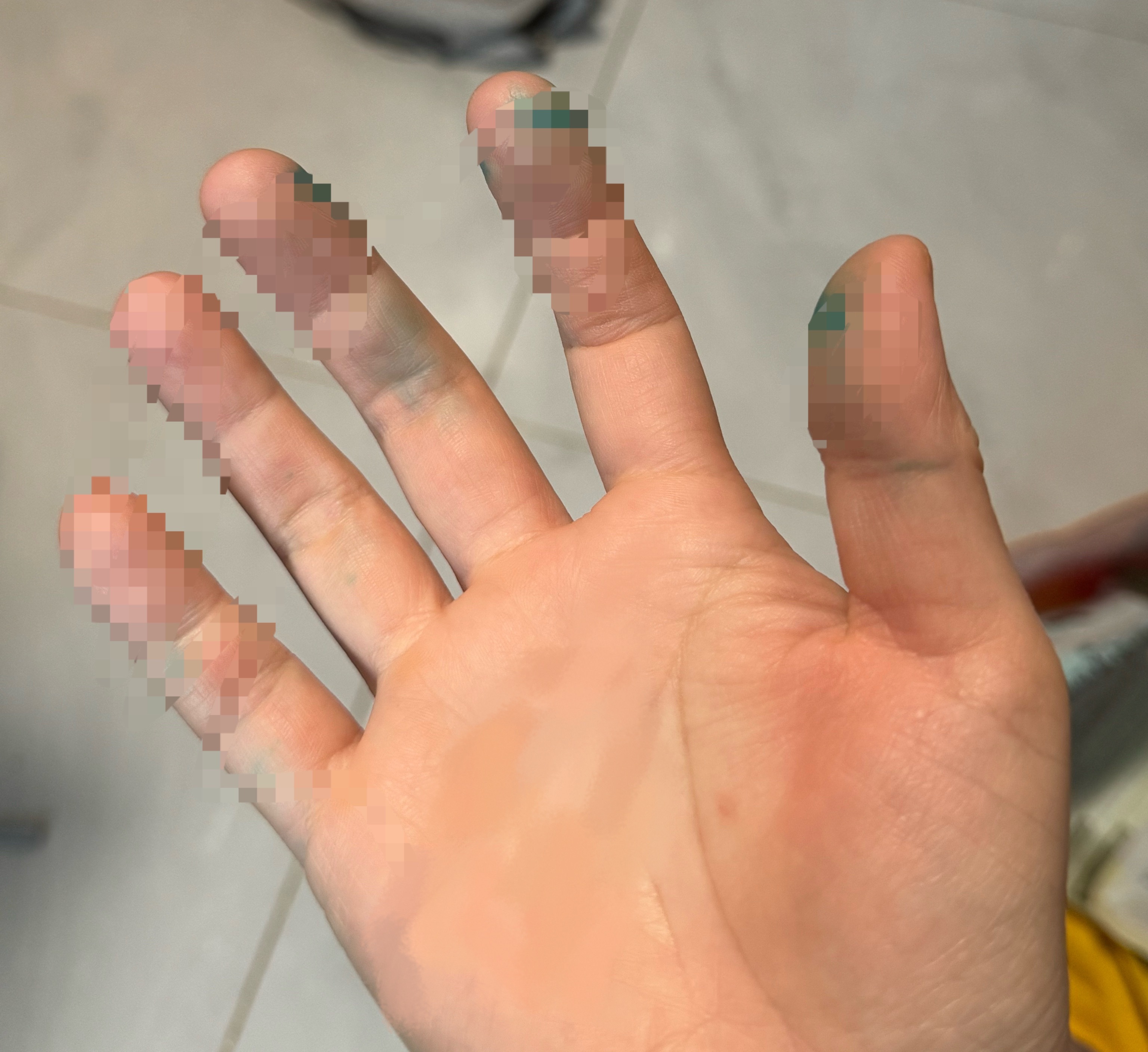 人生就是处处有惊喜备用的这个也老化了，碎了……坏掉那个我都没法拧出来……酥脆的很