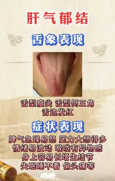 舌头会说话！6 种舌象看懂身体的虚实寒热