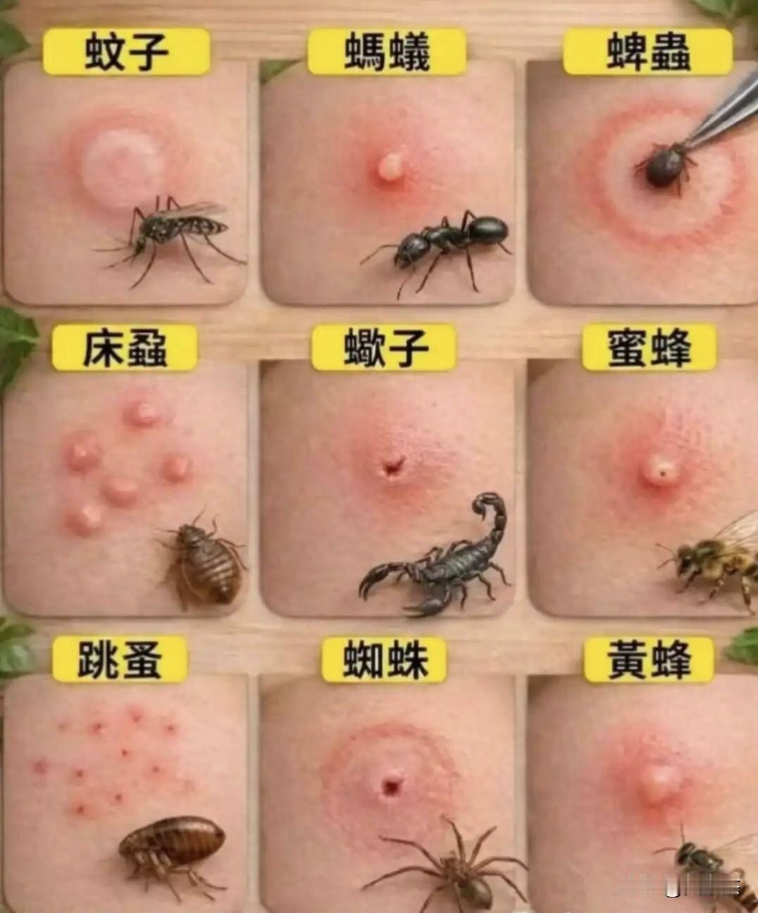 各种叮咬，最怕蜱虫了～～[恐惧]