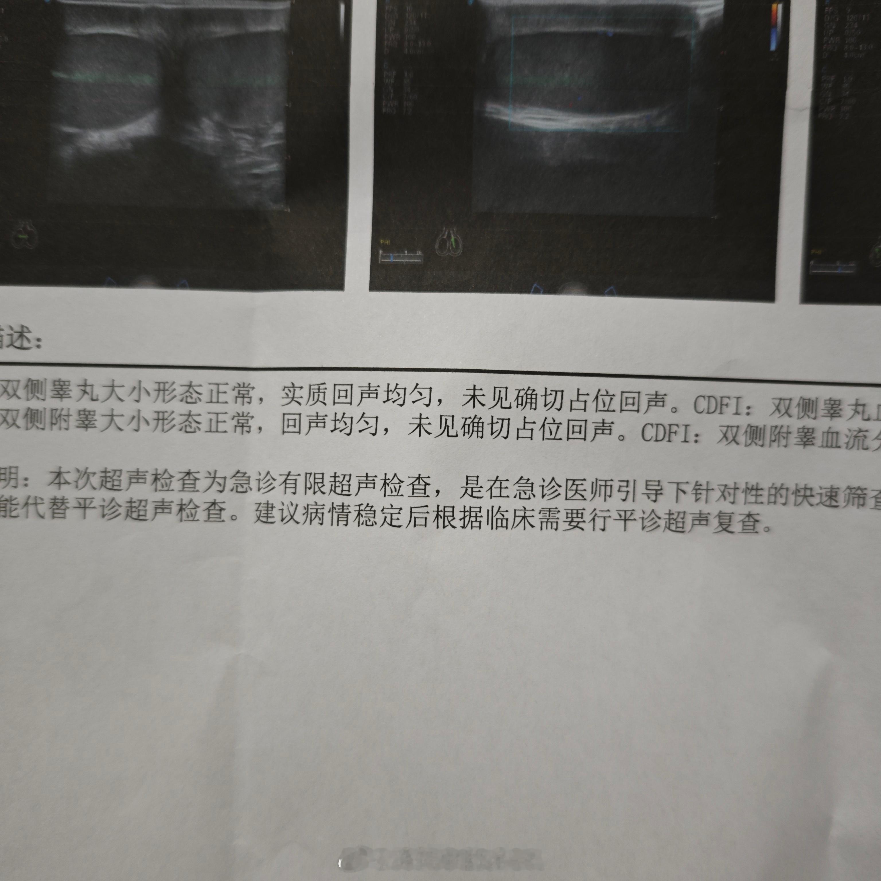 真的好想死大晚上蛋疼+小腹绞痛在家忍了两个多小时实在扛不住了 去医院急诊了屁股上