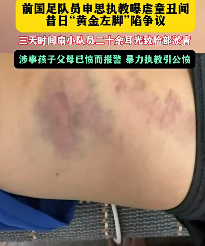 【中国足协通报申思、祁宏参与青训事件】#申思祁宏终身禁业#  7月18日发布情况