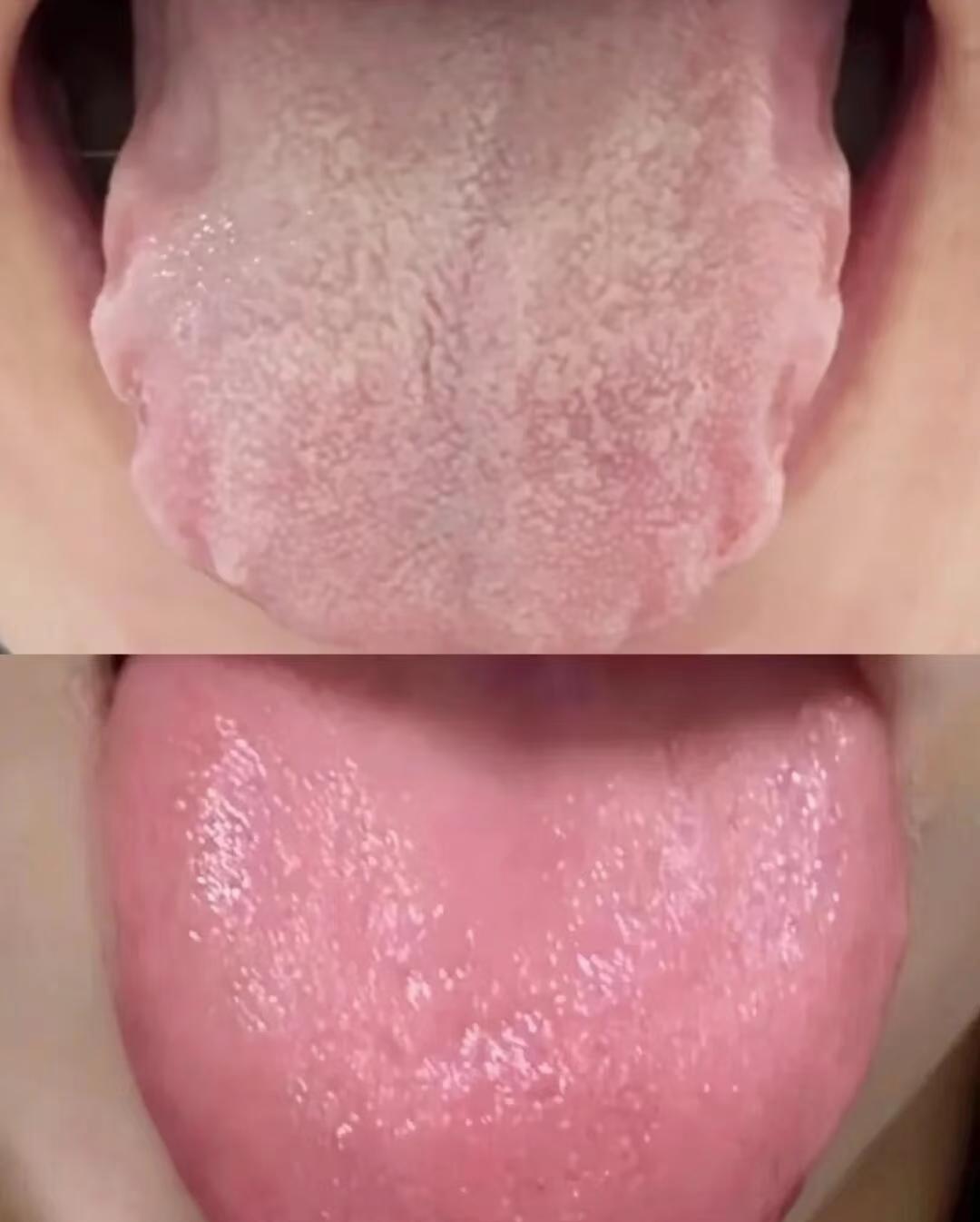 “喝凉水都长胖”？肚子松软、身体沉重，可能是“湿胖”在作怪！别急着节食，方向错了