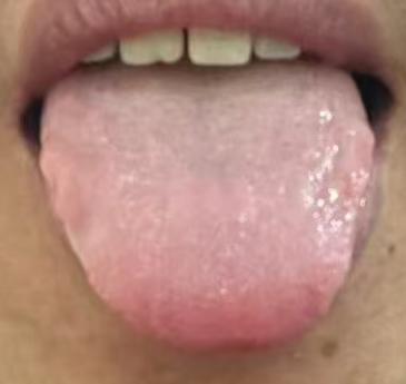 肾精耗损引发诸多不适，正确调理思路分享






常有不少朋友问我：明明一直在