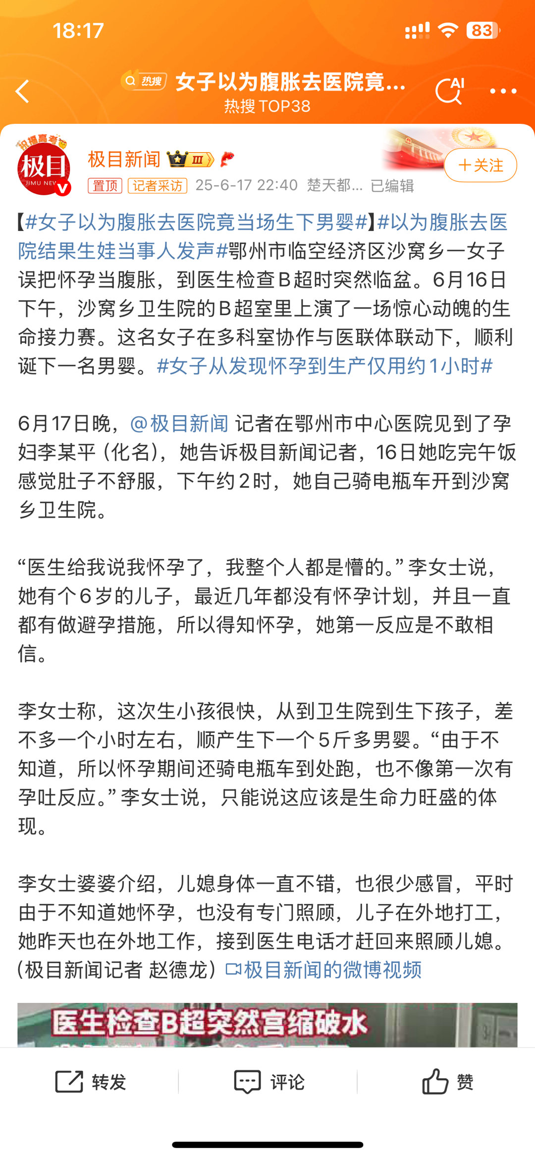 女子以为腹胀去医院竟当场生下男婴前几天还看到有个提问，说生孩子是多少多少级疼觉，
