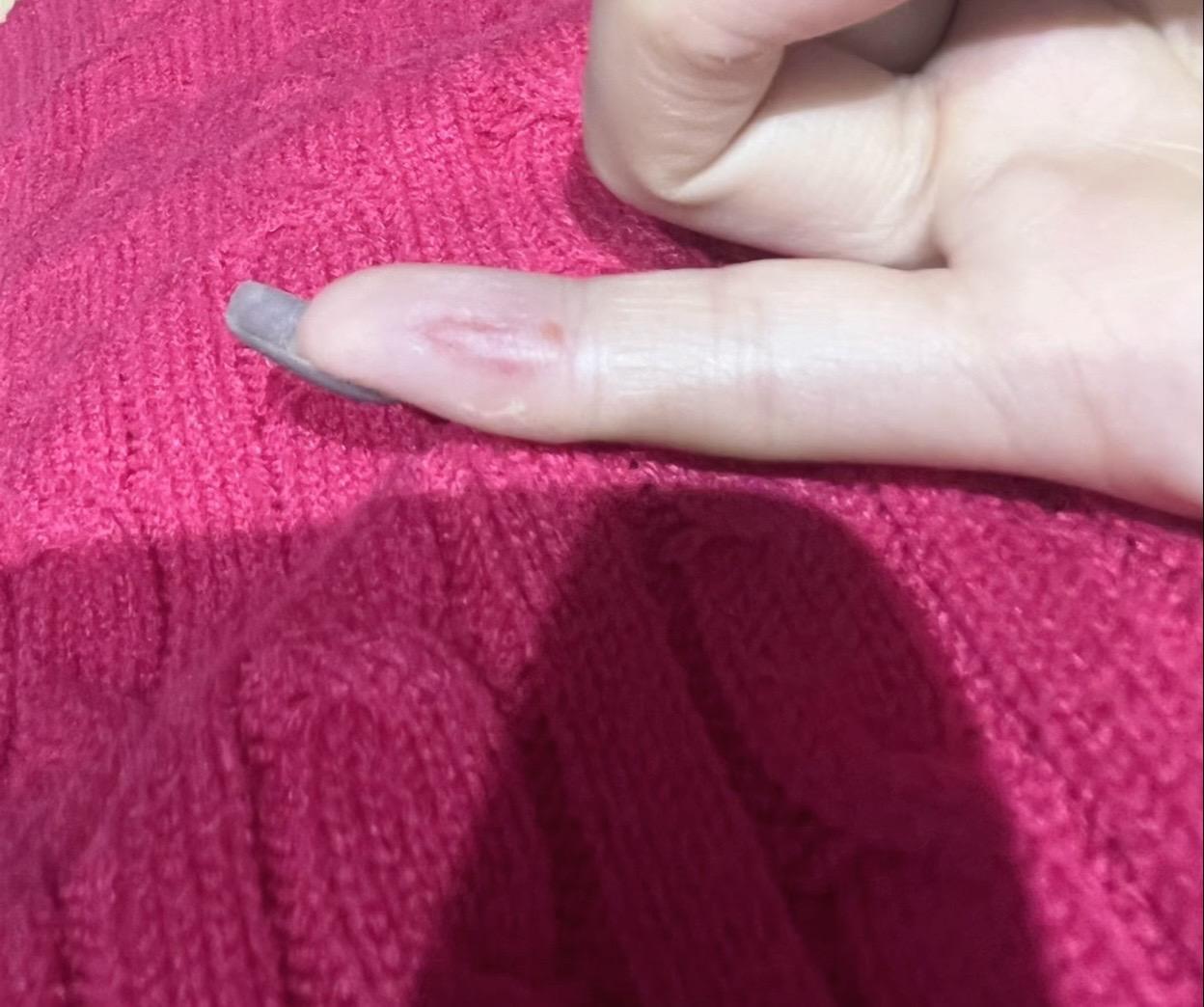 也不知道怎么摔得哪里都疼