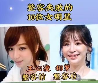 整容失败的10位女明星
看看前后差距有多大