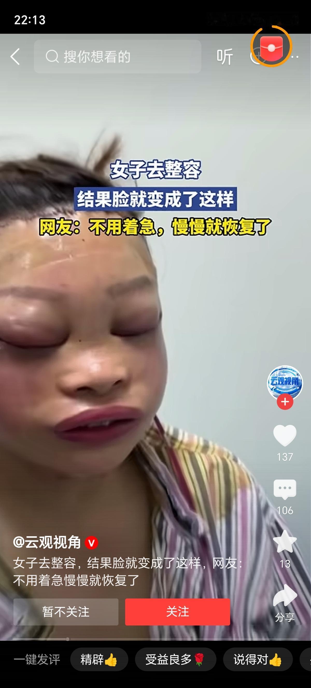 整容的人现在都怎么样了这是花钱把自己整成青蛙了吗？果然，整容是有钱人玩的游戏，这