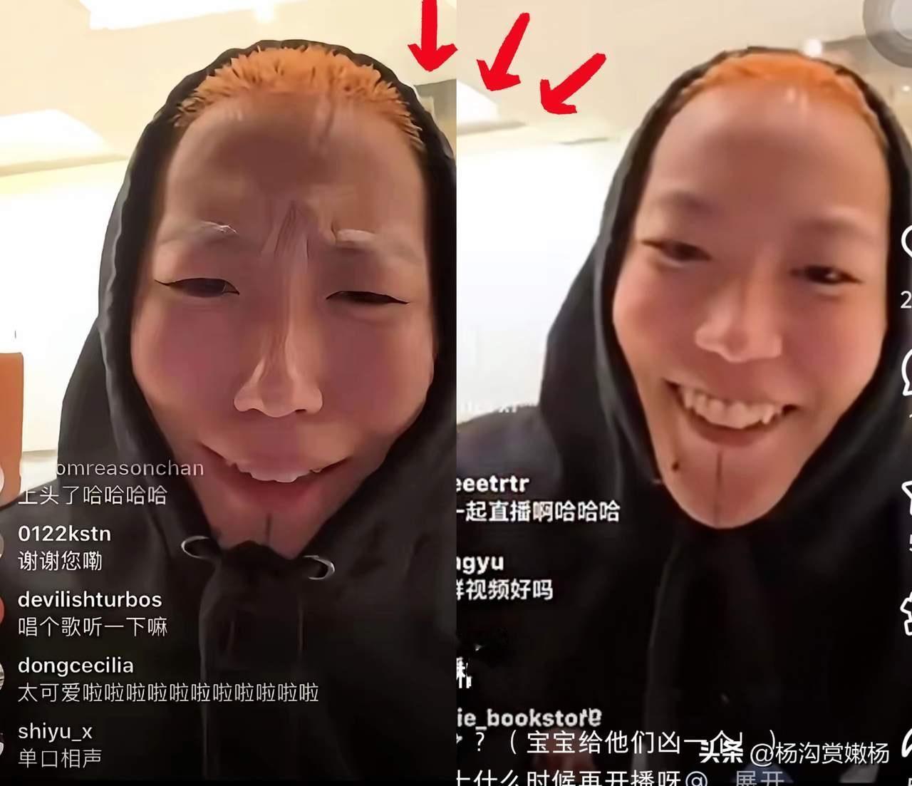 窦靖童疯了？直播扯出窦唯秃头基因，王菲看了都得捏把汗！

“我这头发掉的，八成是