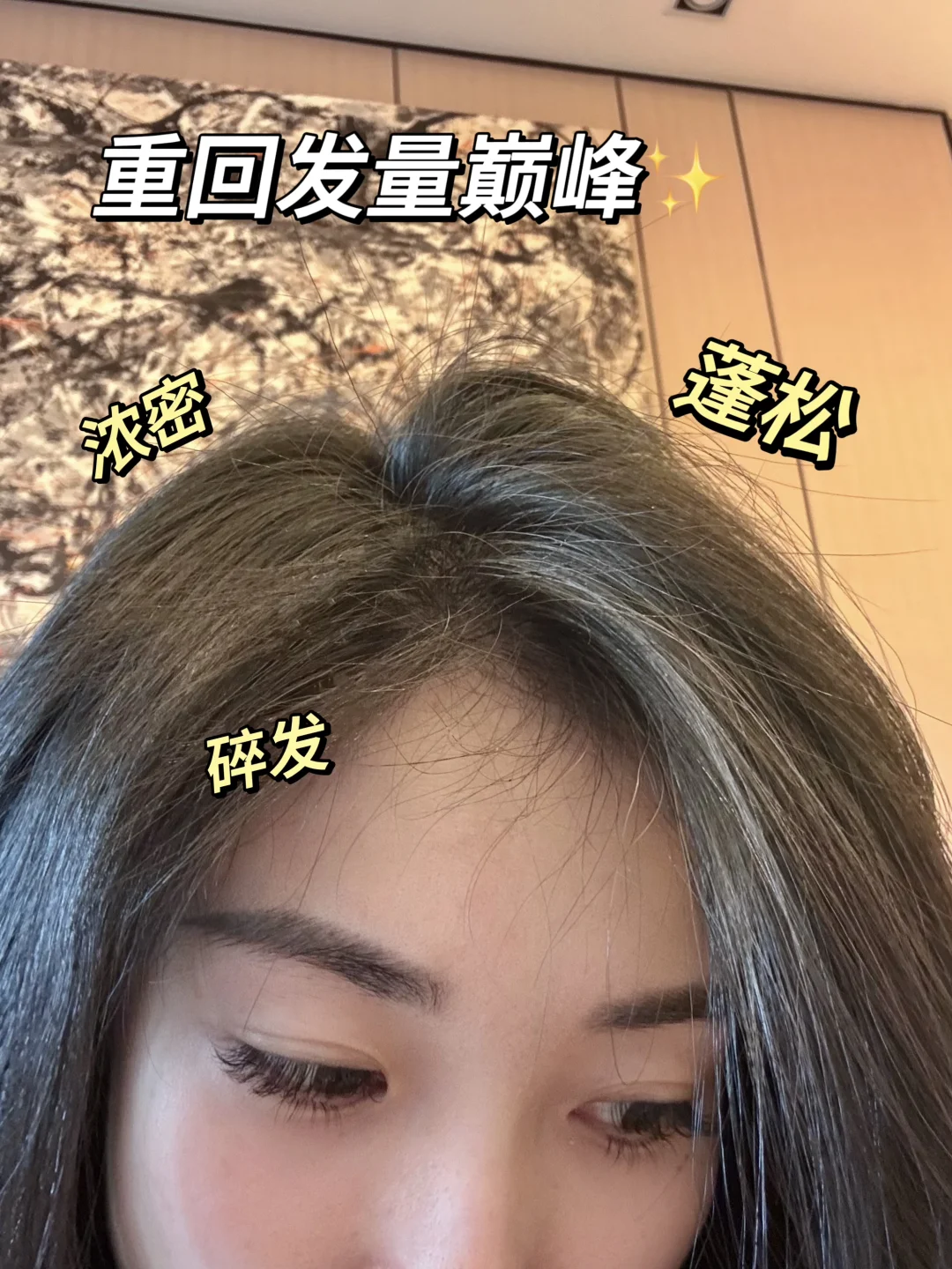产后发缝宽到透光？！我的爆毛救星来了！