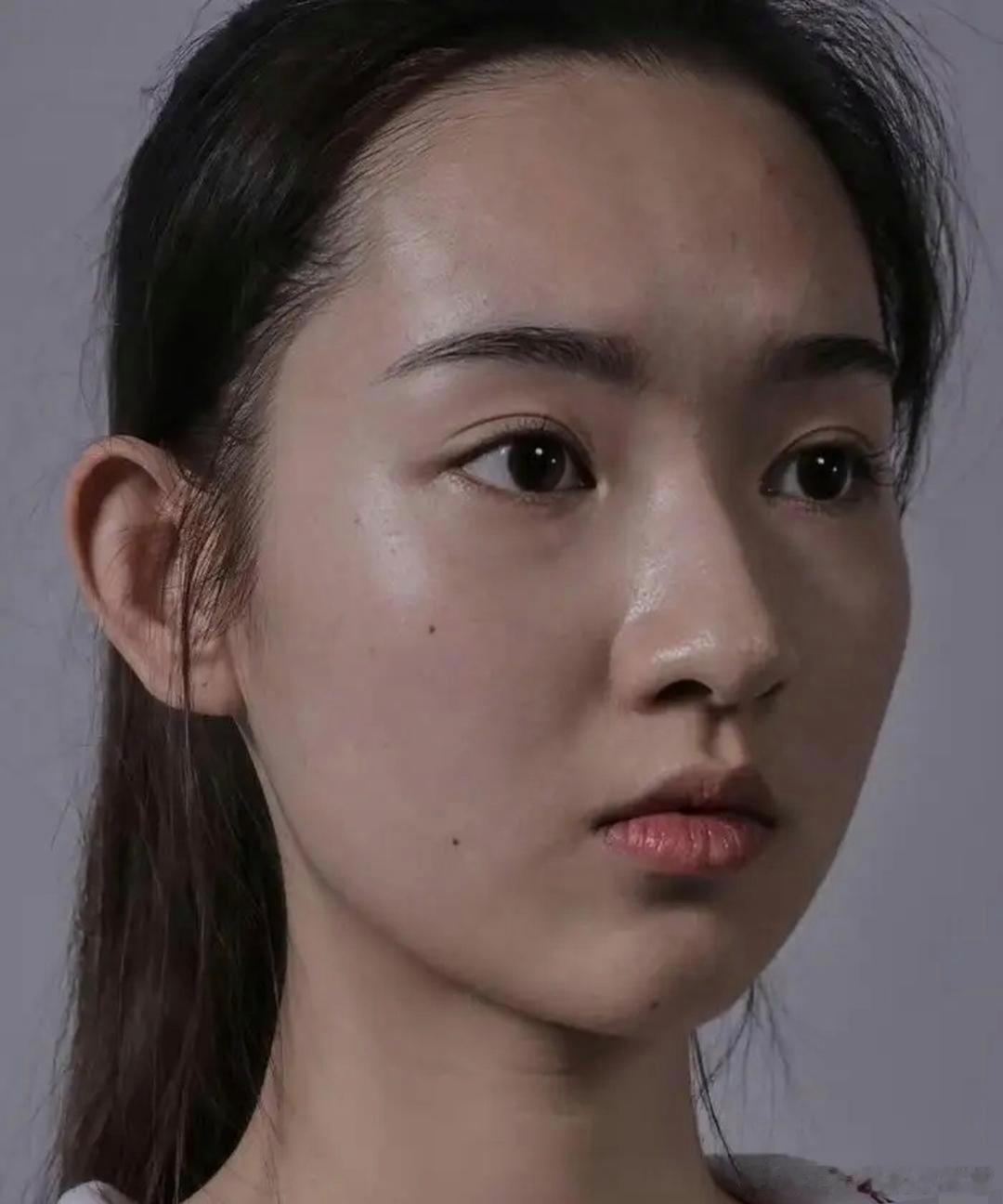 实拍镜头直击王玉雯素颜模样。褪去舞台妆容加持后，她脸上的痣点清晰可见。没有光鲜滤