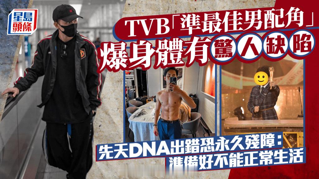 星岛：TVB“准最佳男配角”爆身体有惊人缺陷 先天DNA出错恐永久残障：准备好不