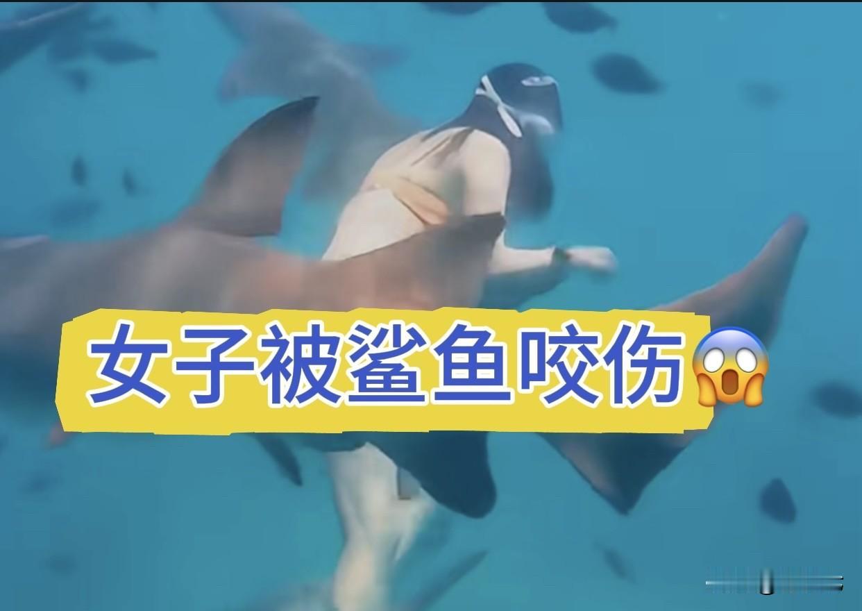 70%截肢率‼️女子被鲨咬后炫耀狂笑引众怒
女子马尔代夫被鲨咬伤，面对截肢警告竟