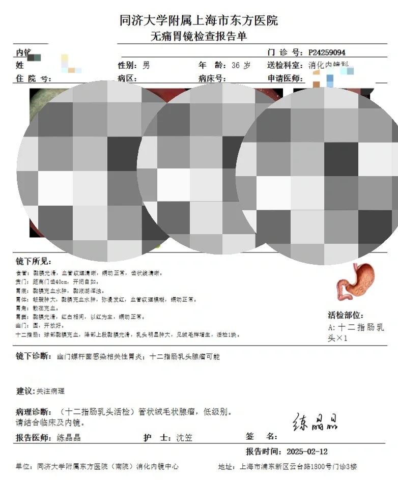 36岁的乳头腺瘤-胃肠镜体检的意义