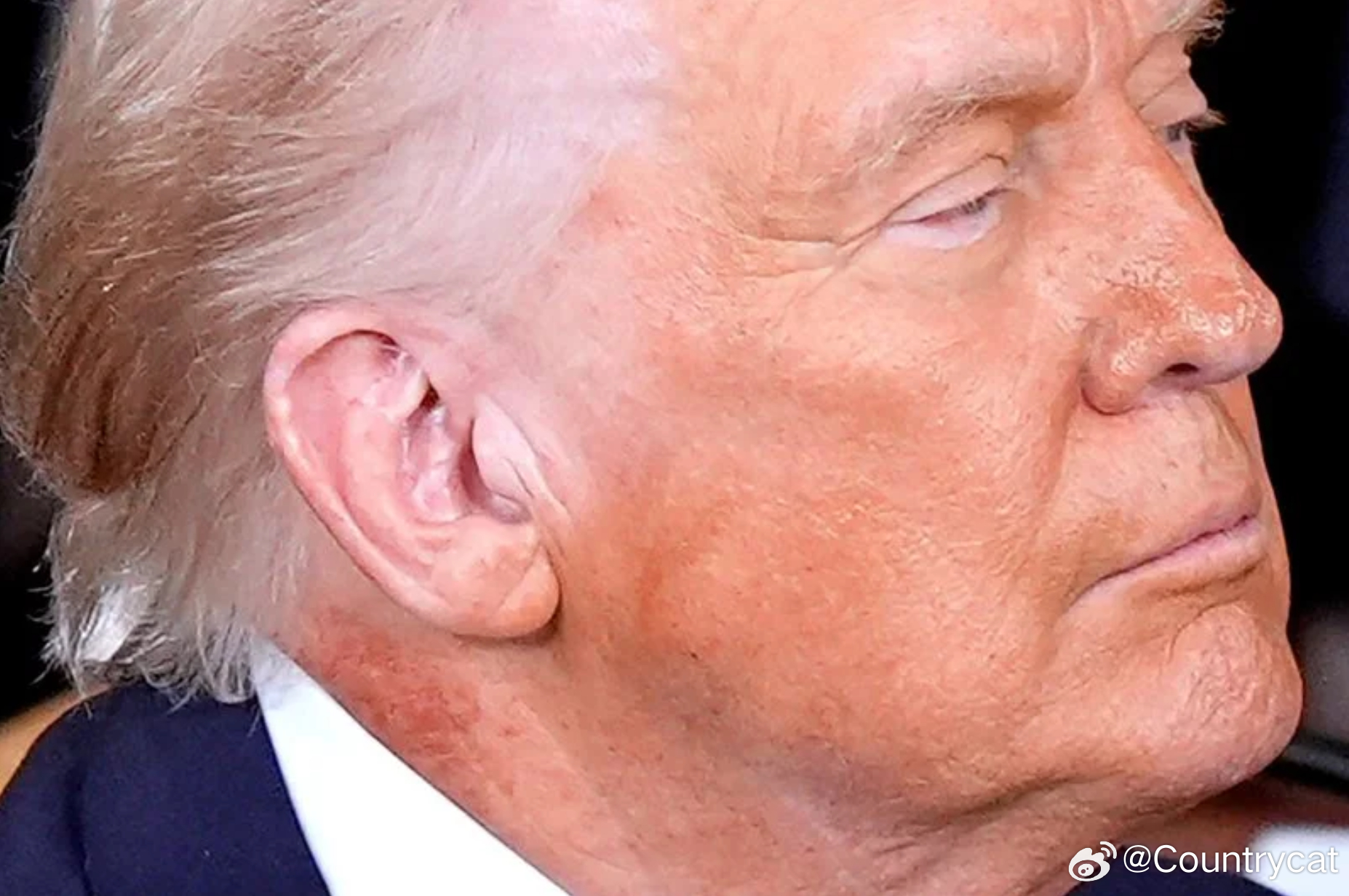 特朗普颈部出现大片红斑引关注 白宫称系涂抹常见皮肤药膏所致海外新鲜事 美国白宫2