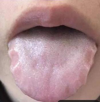 补阳第一，补气第一，祛湿第一，补血第一，四个问题四个舌象对应四个方子！

 
 