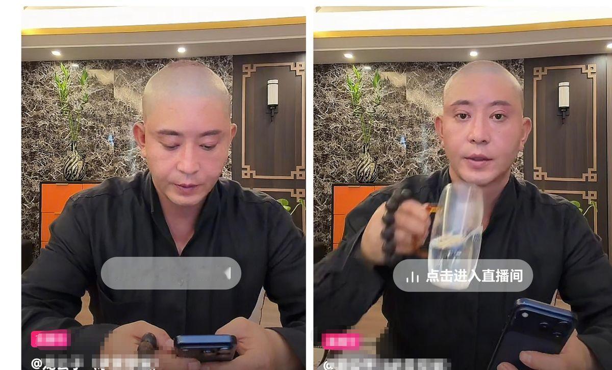 光头、双眼皮、面部填充，还要植发——一个大男人把脸当成试验田，折腾得比姑娘还勤快