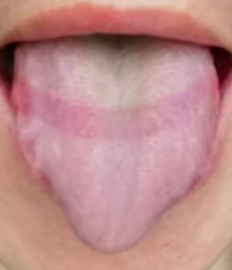 年纪渐长状态下滑别慌，中医温补调理，守护自身元气






有不少朋友过了中年