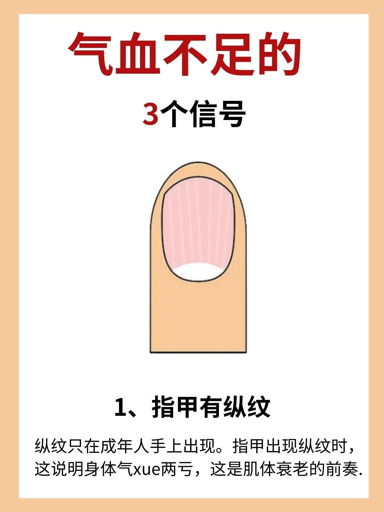 气血不足的三个信号1、指甲有纵纹纵纹只在成年人手上出现。指甲出现纵纹时，这说明身