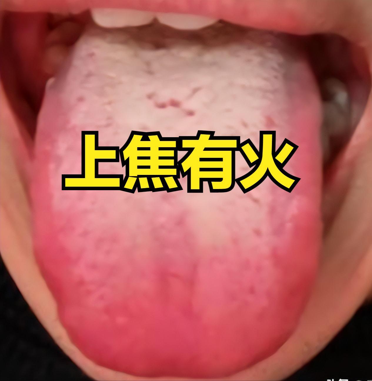 经常出汗？看这 3 个部位 + 舌象，秒懂原因！
很多人觉得 “出汗是正常现象”