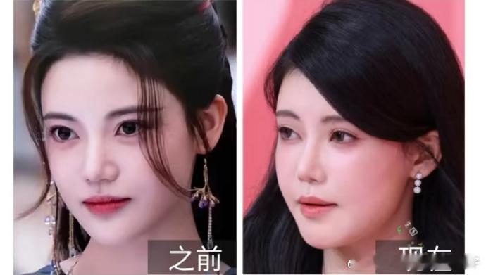 姐，这怎么前后差距这么大啊[疑问]虽然自己说没有想不开，只是肿了，可是真的没有以
