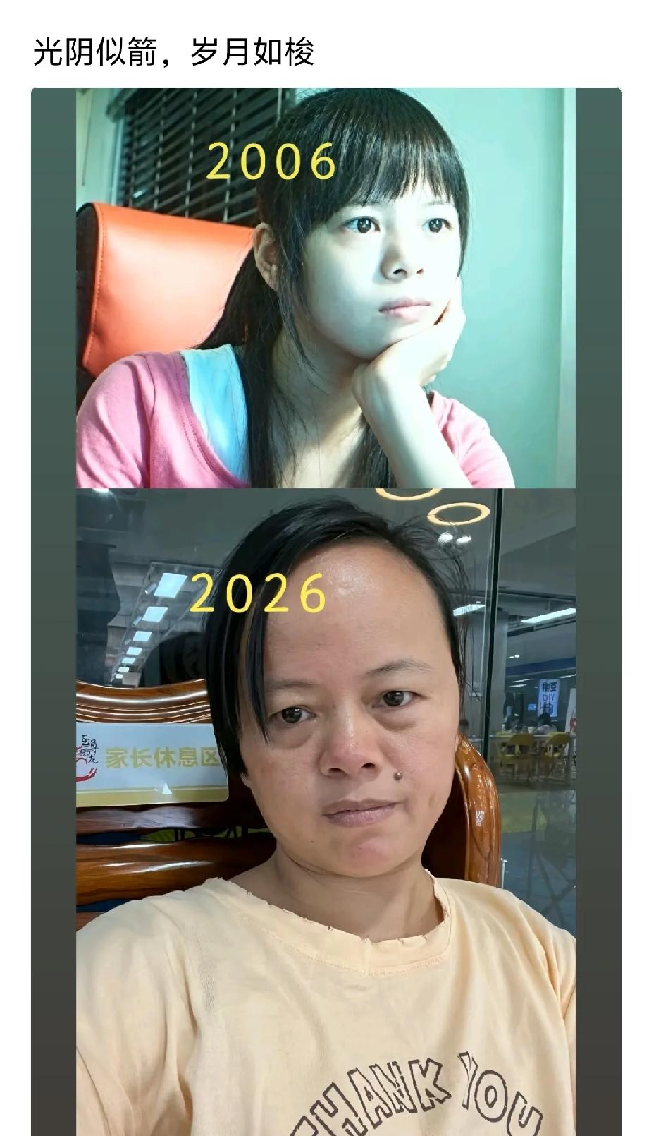那个痣，能不能花几百块钱搞掉？！[捂脸][捂脸][捂脸]