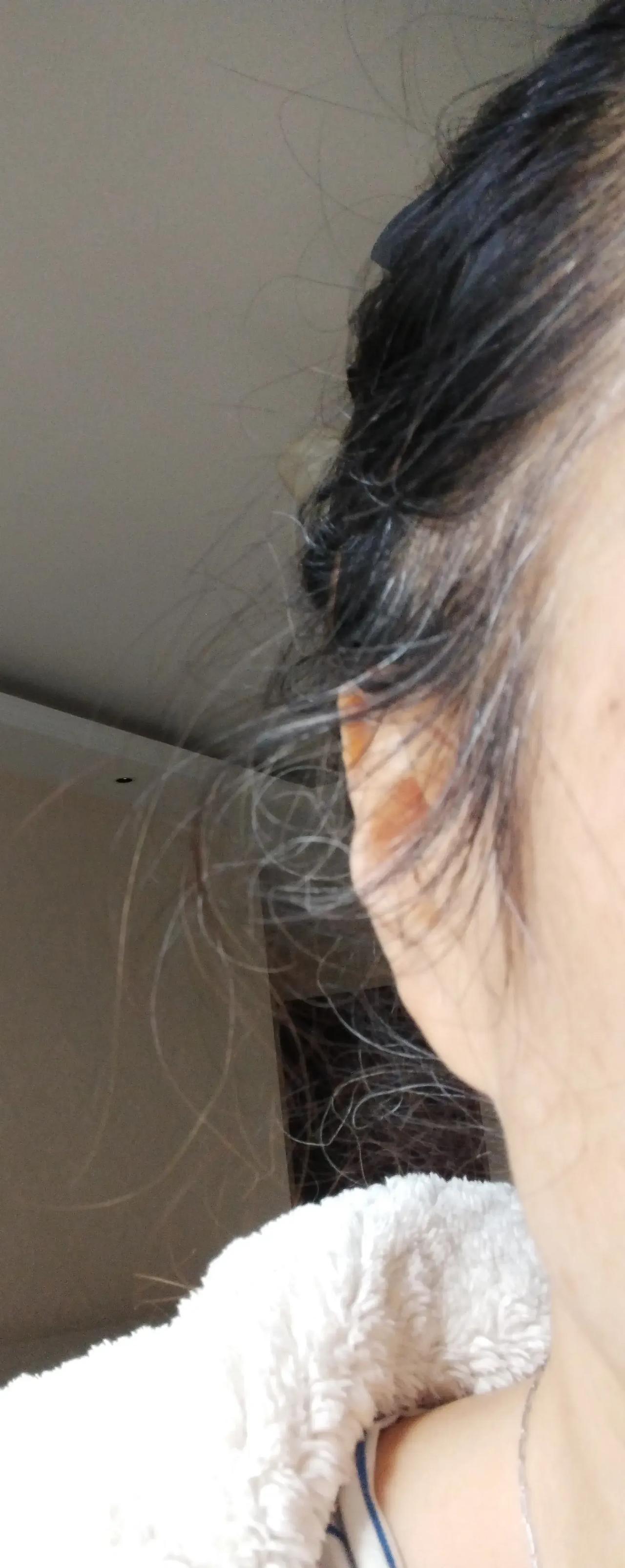 不敢看，原来满头乌黑浓密的秀发，现在掉的越来越稀，头皮都快遮不住了，每天梳头都是