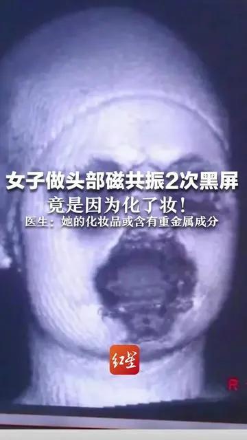 杭州一女子做头部核磁共振，机器启动后黑屏两次，无法正常扫描，核磁共振仪器公司派工