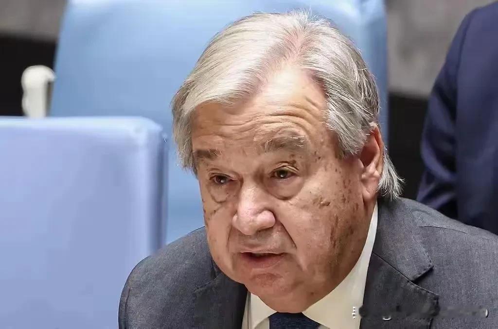 联合国秘书长古特雷斯算是一个奇葩。在以色列的球员在荷兰被暴揍之后，联合国秘书长古