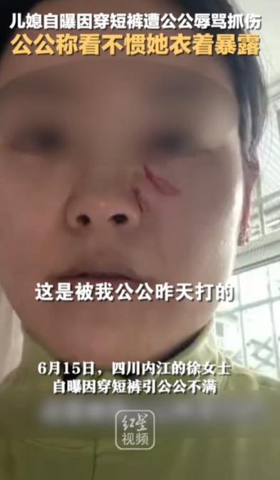 "清官难断家务事！" 四川，一儿媳因天气热穿了条白色短裤，竟被 50 多岁的公公