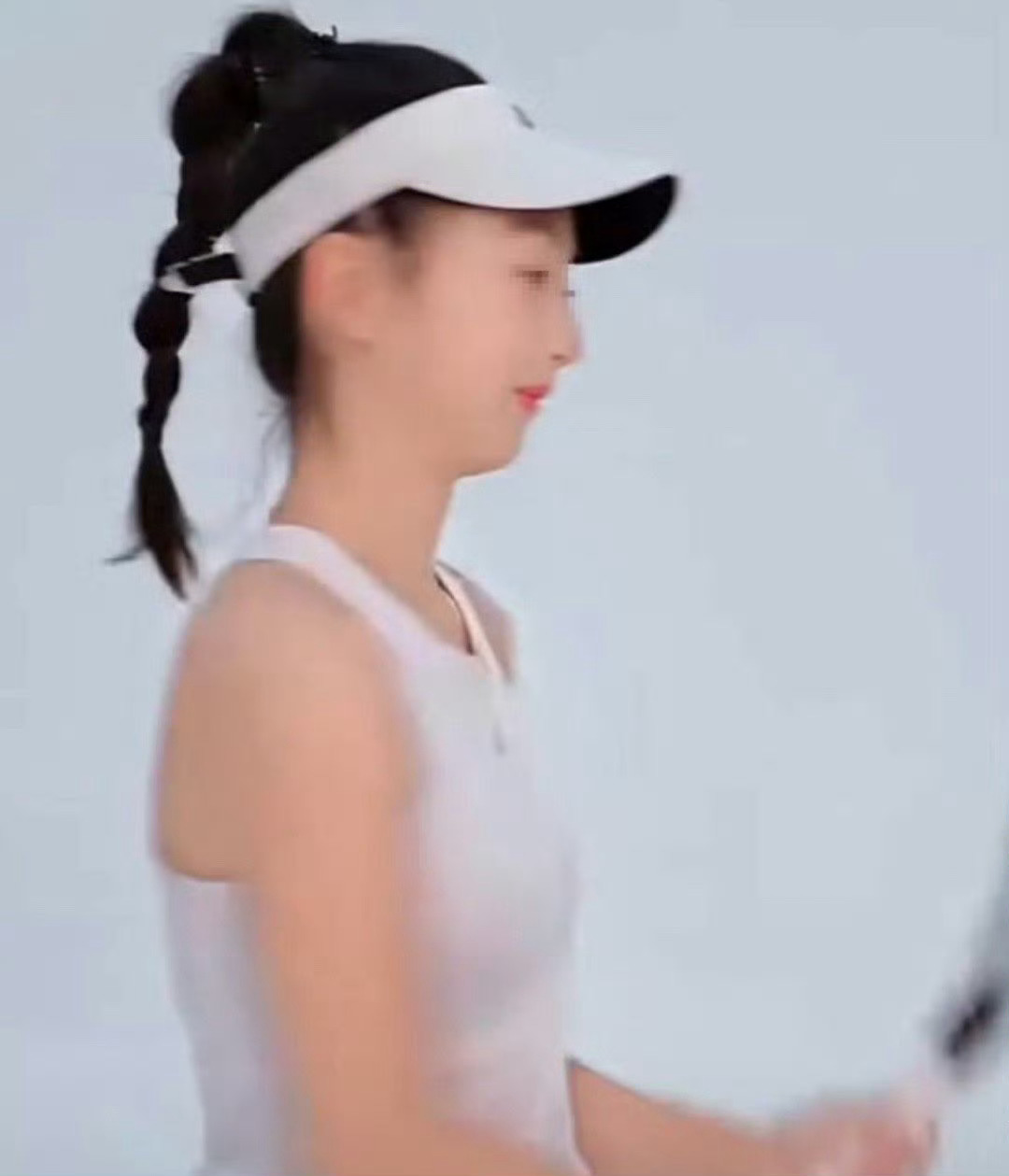 森碟下巴后缩改善了很多我咧个豆，这是去整容了吧森碟｜ ​​​