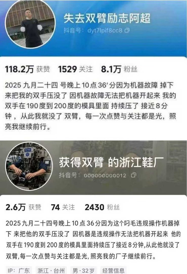 #浙江鞋厂 阿超#网传故事设定：2025年9月24日22:36，工人阿超在浙江鞋厂夜班操作高温压模机器，机器突发故障坠落压住双手，设备锁死无法开启。他的双手被困在190-200℃高温模具中长达8分钟，最终双臂截肢。
故事最初包装成“身残志坚励志”叙事传播，后续网友衍生黑色玩梗句子：失去双臂励志阿超，获得 ​
