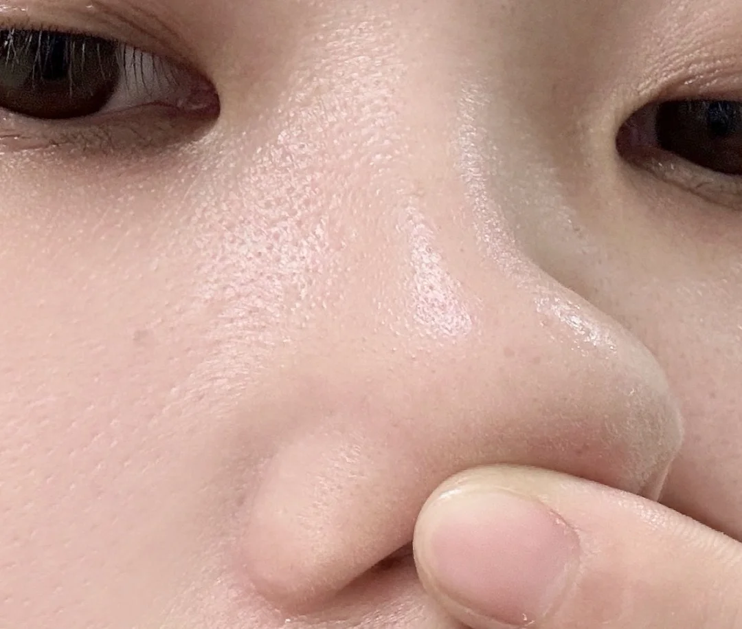 黑头毳毛多的都去oliveyoung买这个！！！！！！！
