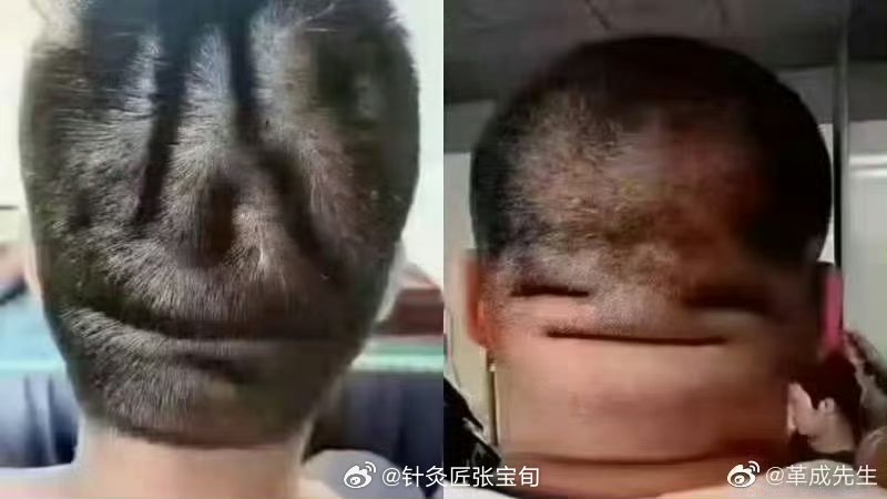 脖子是这样的，特别要小心脑血管的问题，可以用经常来按揉人中或掐按人中...