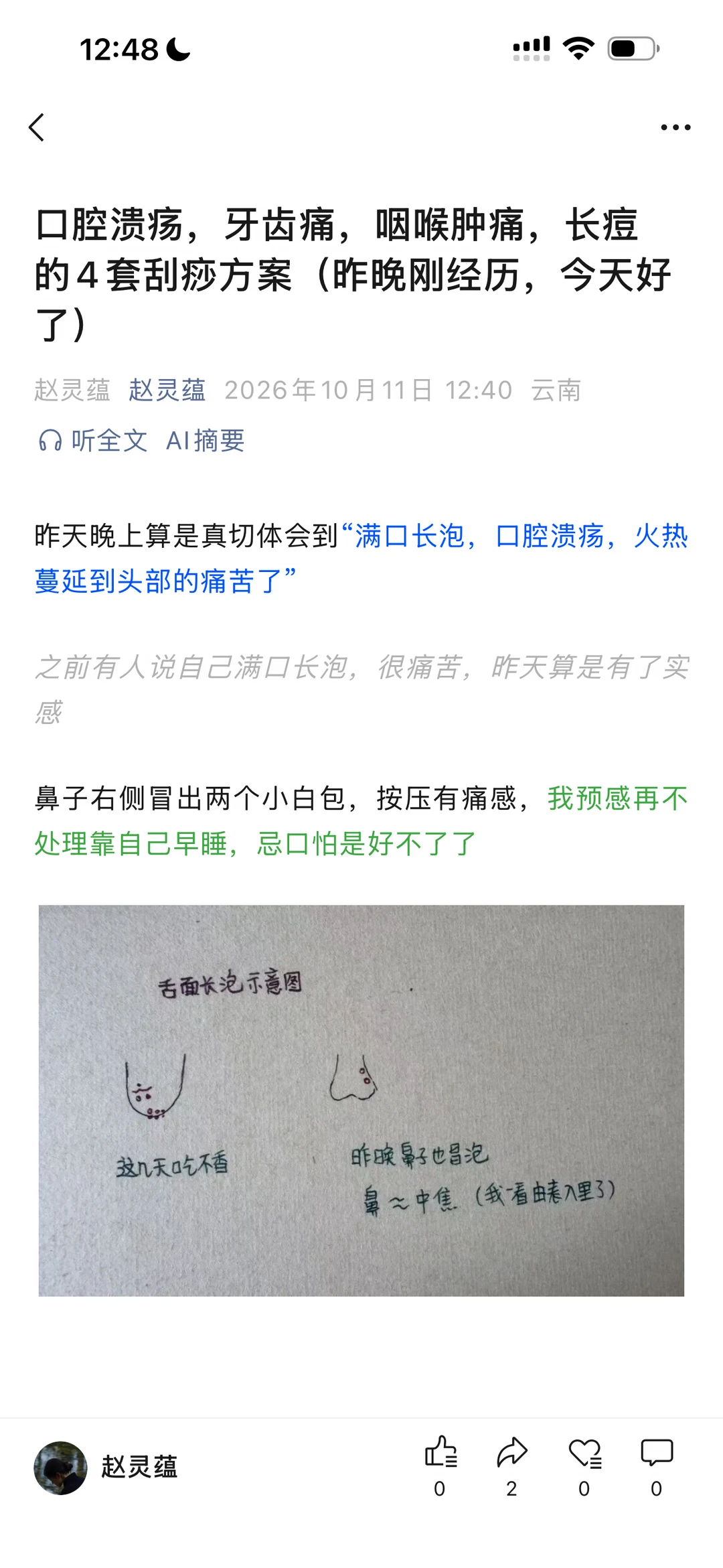 长痘，口腔溃疡，牙痛咽炎：四套刮痧方案（详细