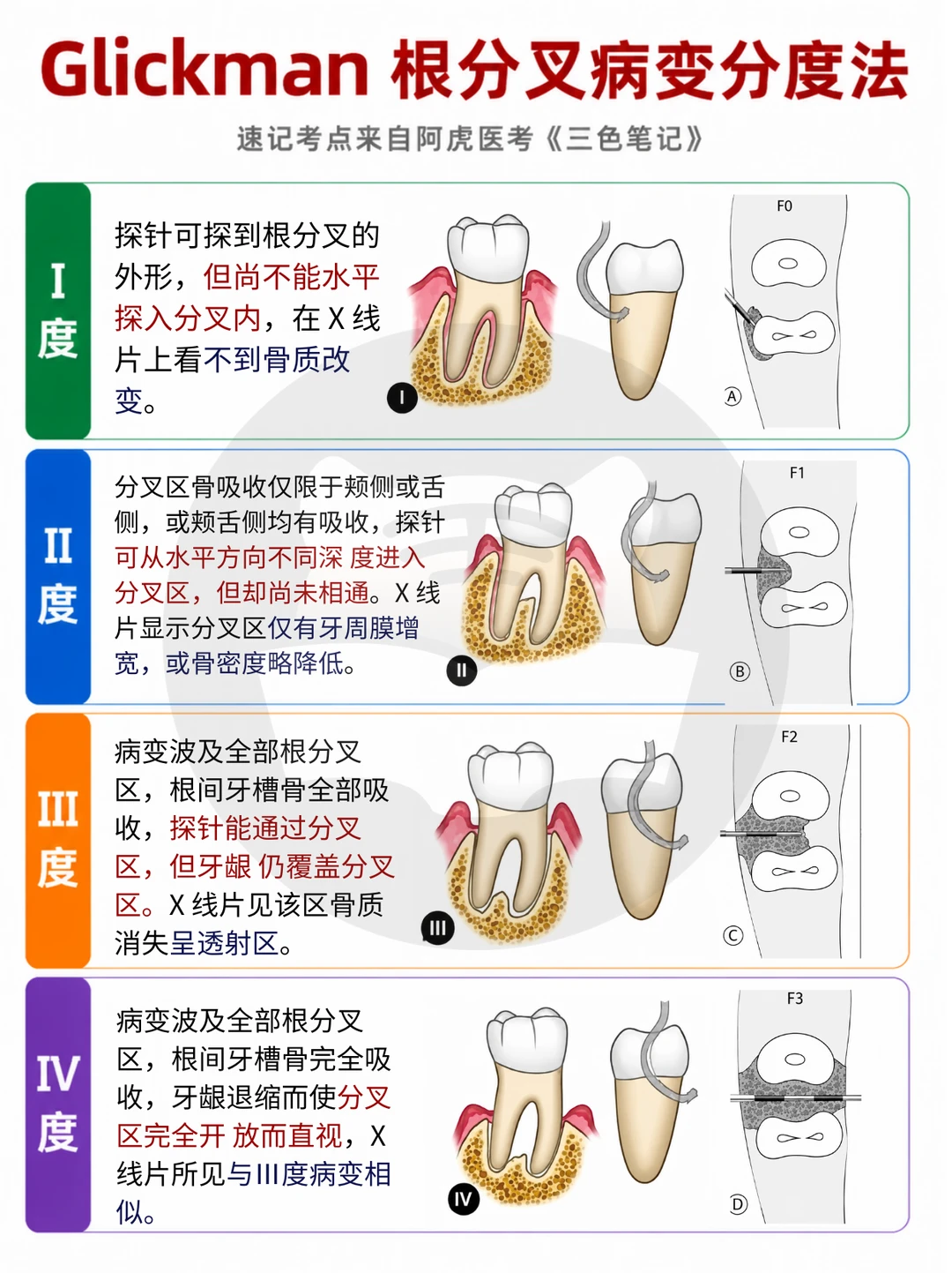 阿虎医考笔记 📒Glickman 根分叉病变分度