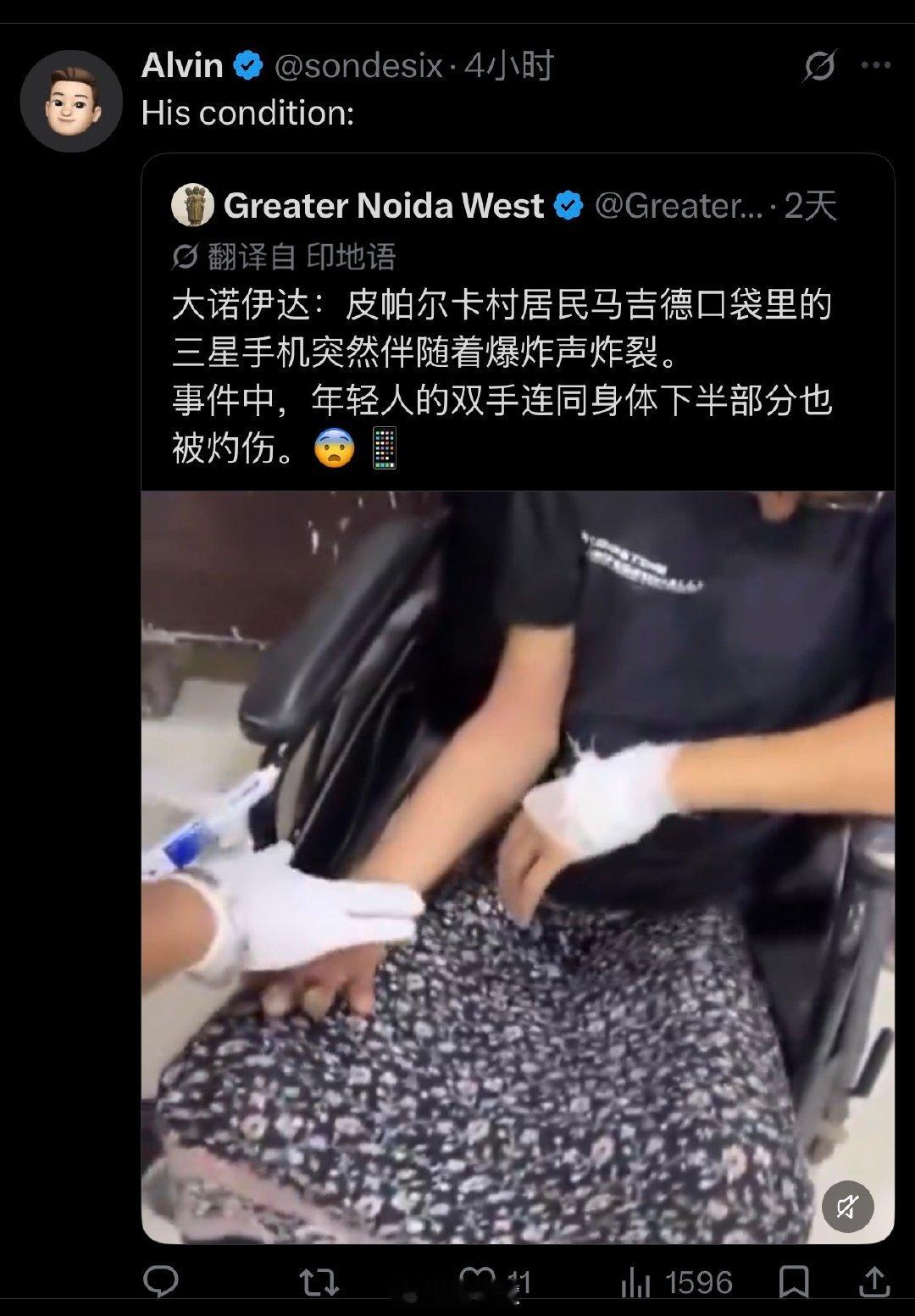 印度一小哥刚买一个月的Galaxy S26 在口袋里炸了。  目前尚不...