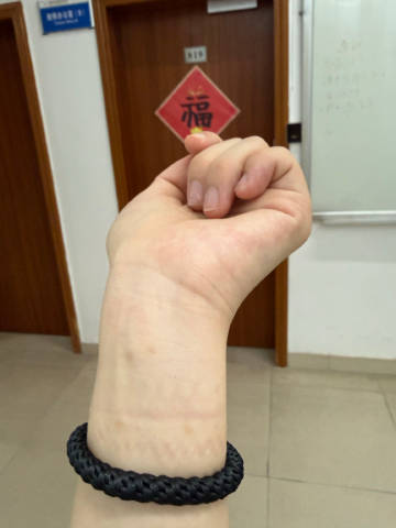 到底是什么过敏哇😧