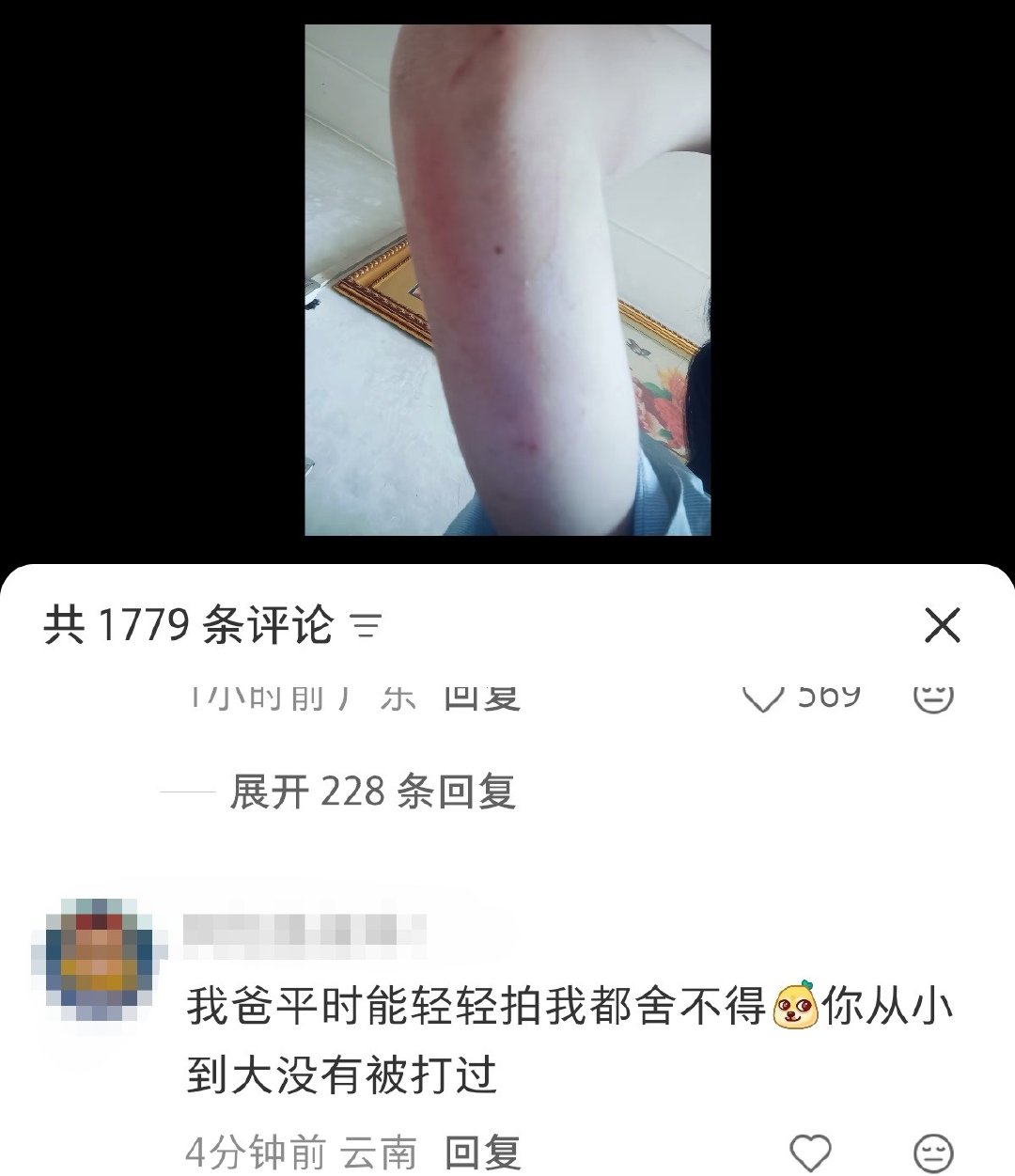 原视频作者在说自己被爸爸家bao。。。有时候不说话也是一种礼貌。

13961 ​
