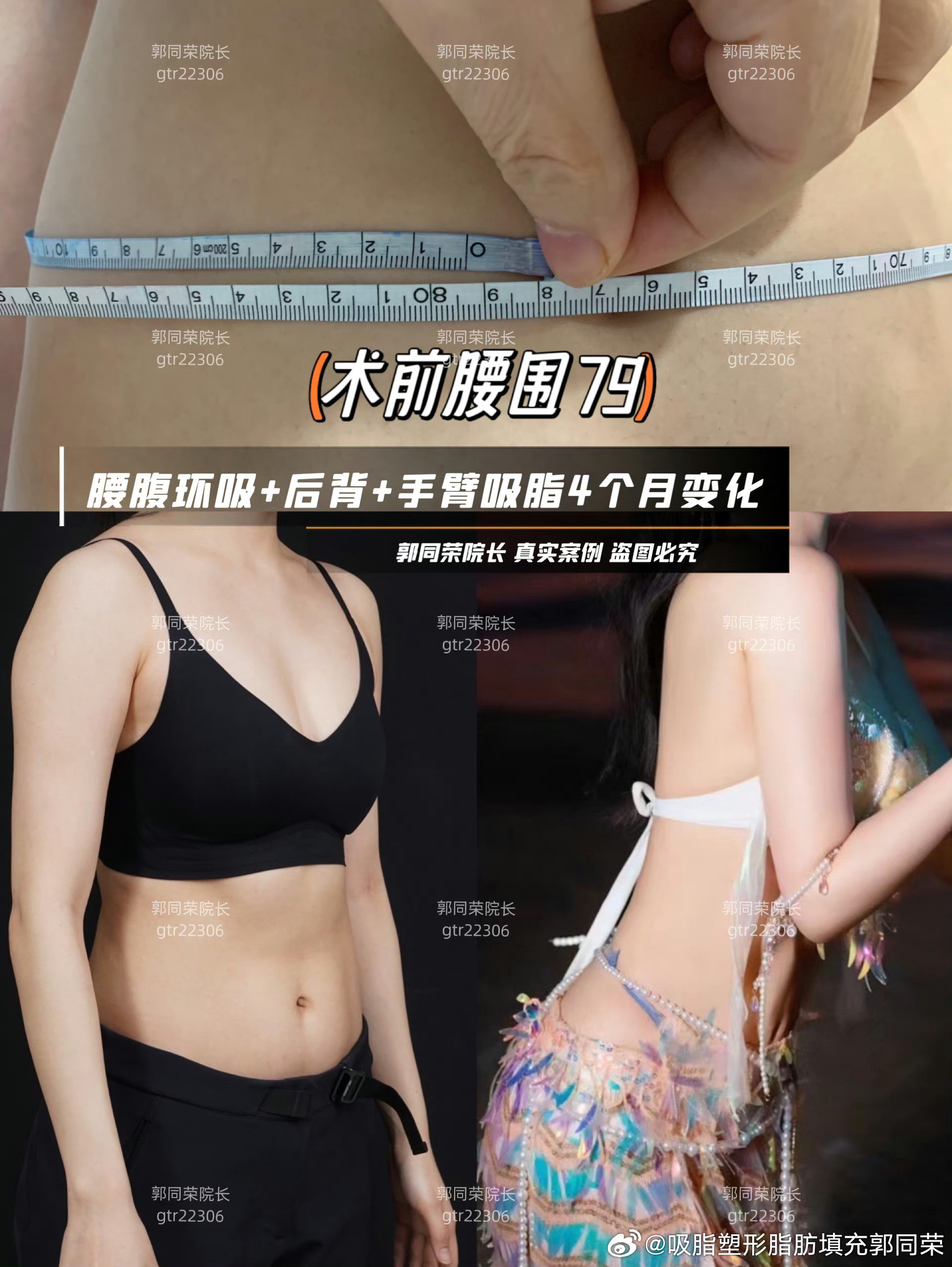 你好，我是郭同荣，咨询请添加：trzd666888  从医30余年，曾...