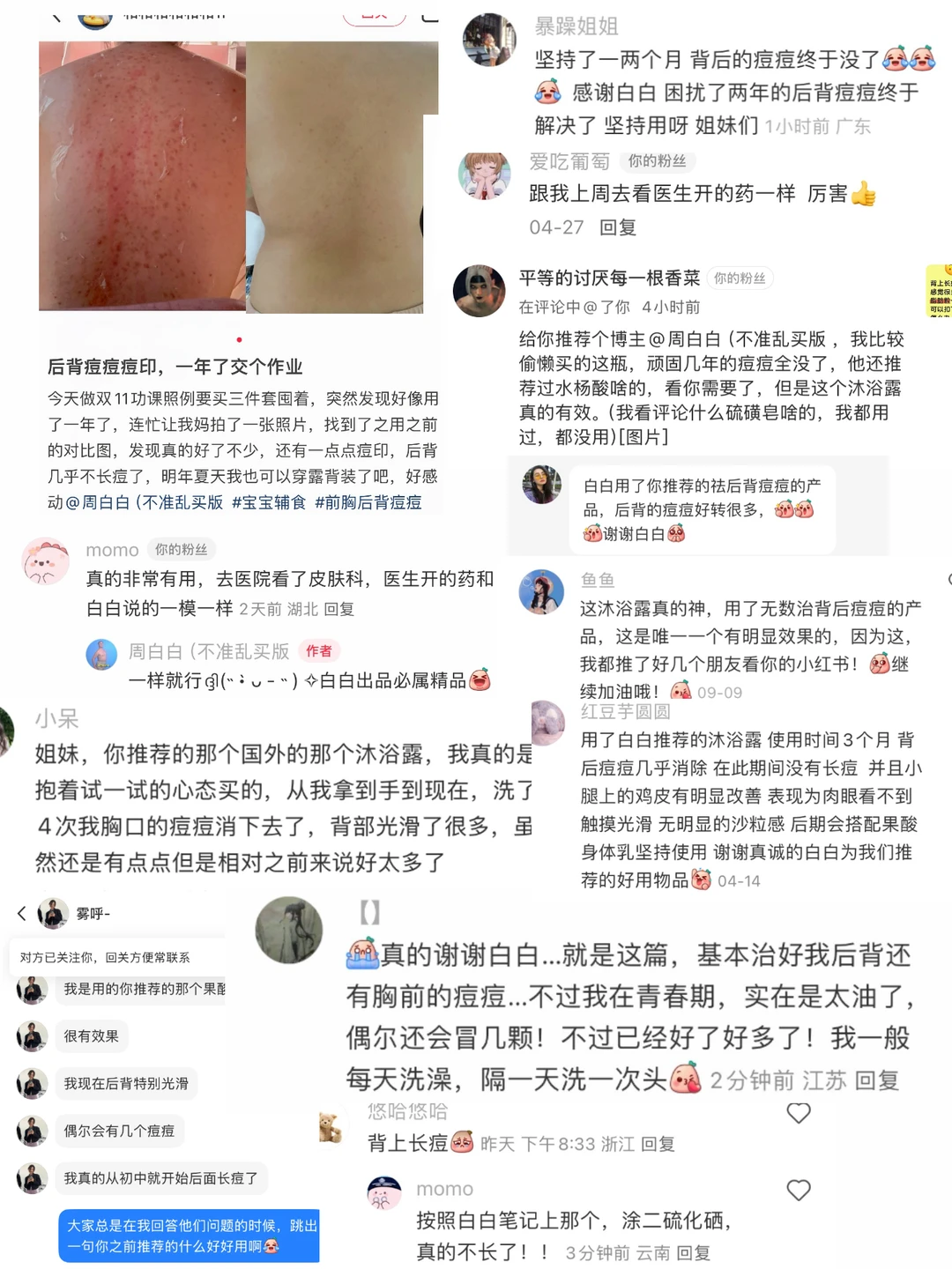彻底解决后背长痘方法！（有广一辈子发不了财