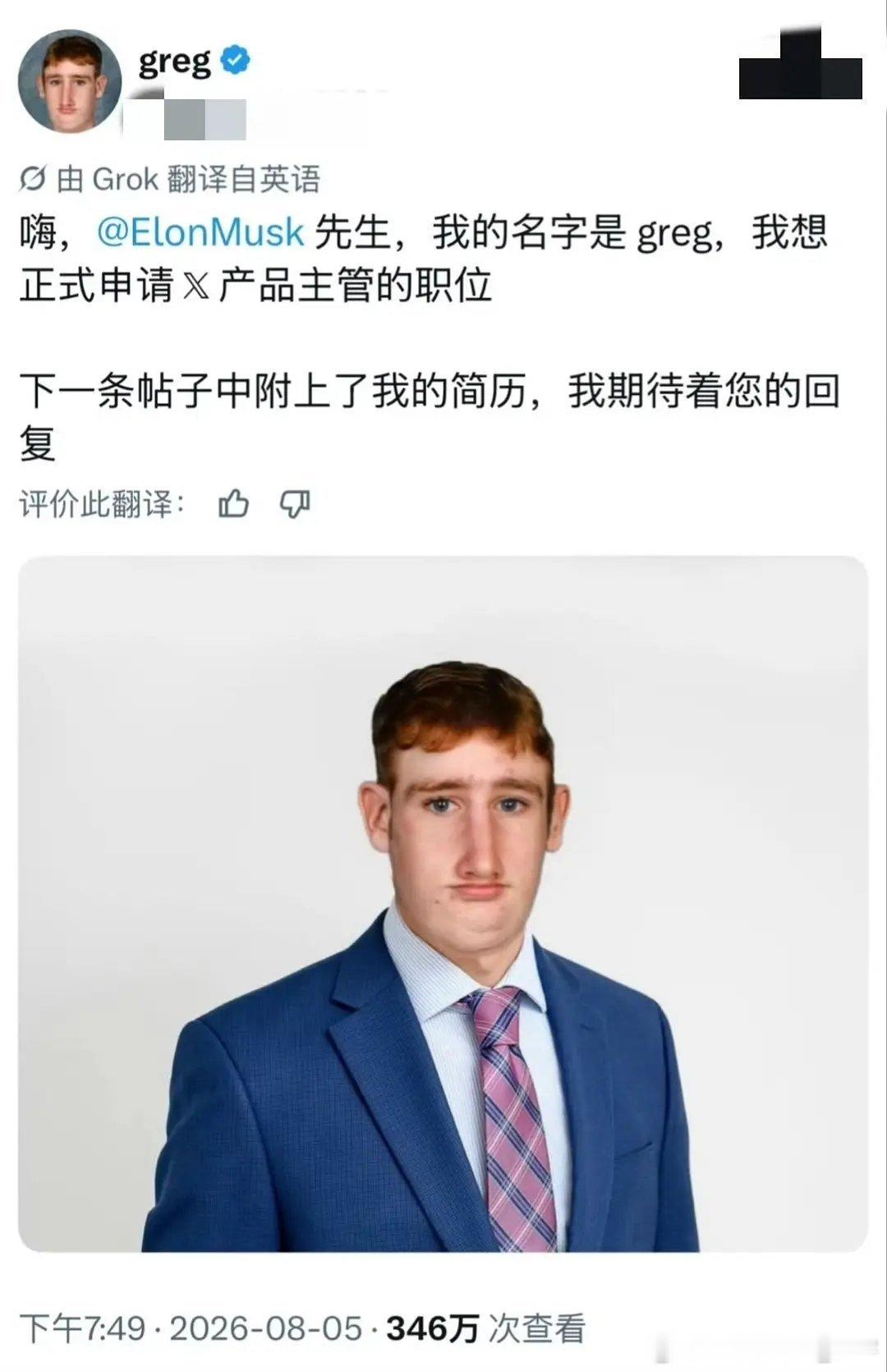 网友神评：晕倒了都没法掐人中 ​