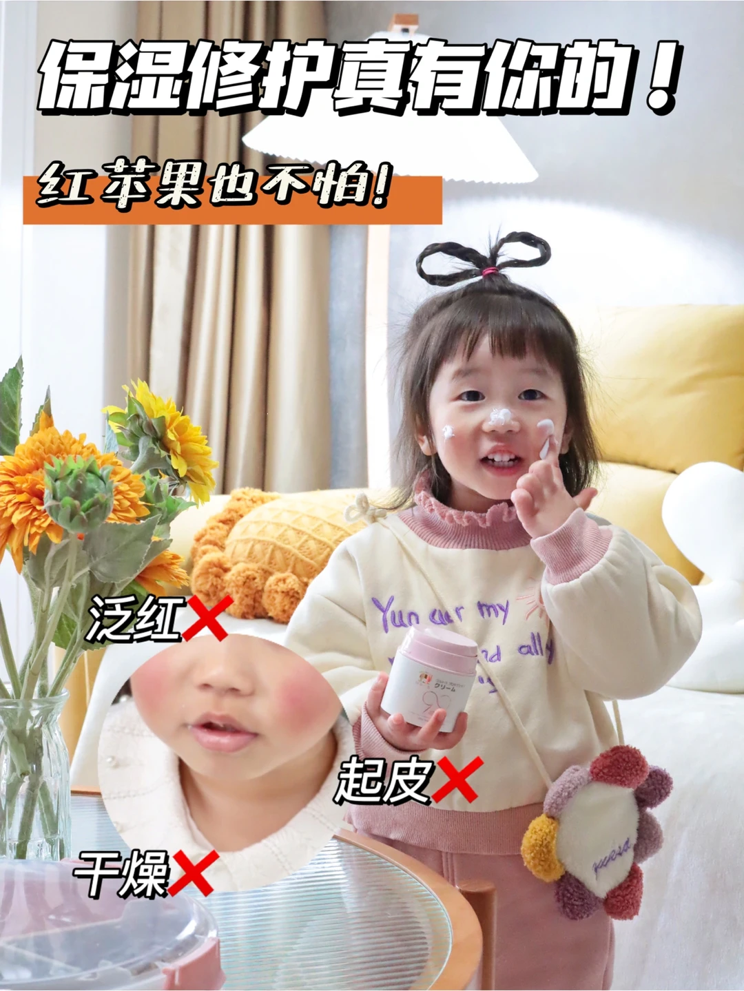 小脸蛋动不动就红？那是该给宝宝抹面霜啦！