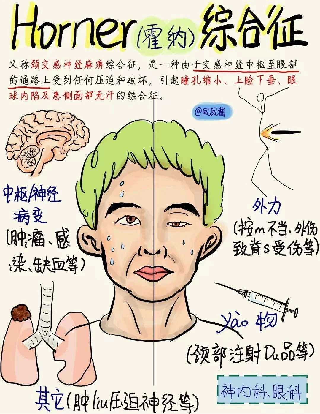 📖医学生笔记｜霍纳综合症 建议点赞收藏