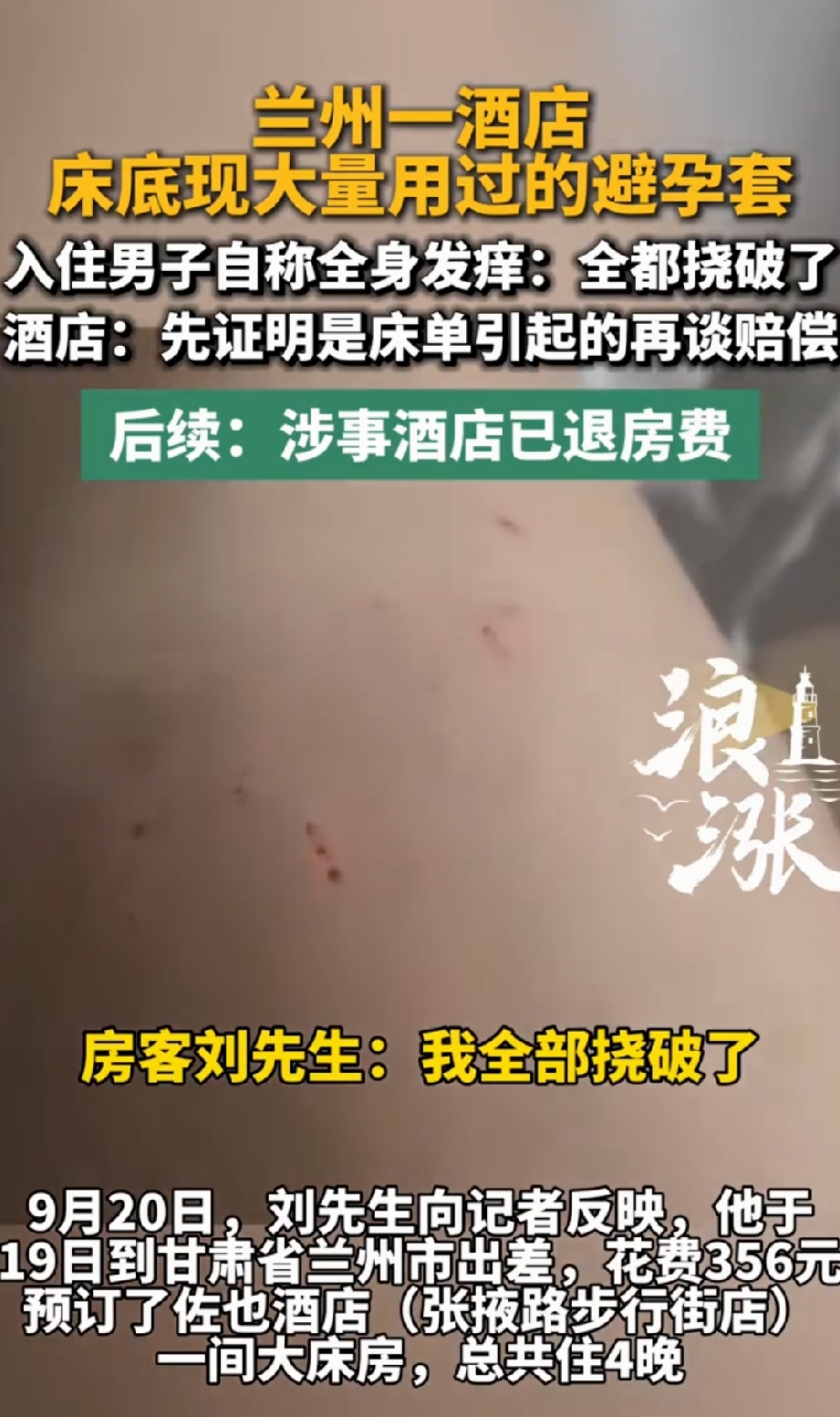 甘肃兰州，一男子出差住酒店，花356元订了4晚，房间看着挺干净，万万没想到，掀开床底，眼前的东西能把人吓一跳：用过的、没用过的避孕套，还有拖鞋、身份证、遥控器，外加厚厚一层灰土！更吓人的是，入住没几天，男子全身发痒，腿都挠出了血痂。更气人的是结算房费，酒店退款时却提了一个条件……

9月20日，在兰