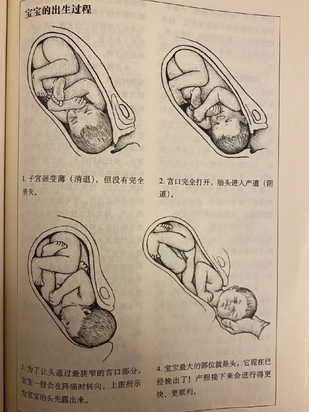 顺产分娩全过程附图️‼️看完我没那么害怕了
