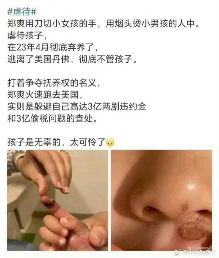 #宁静 谁说小爽坏了#
又虐童又虐狗，素人爽你真的没有良知吗？
虎毒还不食子呢，种种行径简直触目惊心！[泪] ​