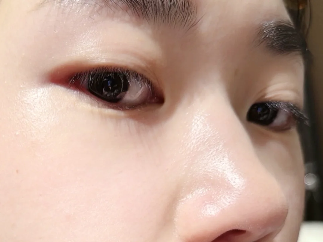 强推一个日本的毛孔注氧剂